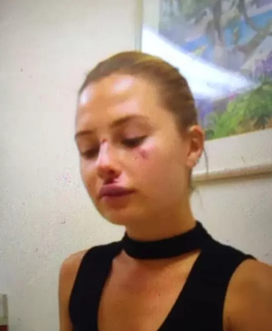 Model Chloe Loughnan, Serdar Ortaç ile evlendikten sonra boşandıklarının nedenlerini özetle kumar bağımlılığı, kötü konuşmalar, trafik kazası sonrası deneyimler ve ilişki sorunları olarak açıkladı.